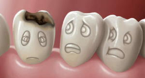 الفلوري سواء معجون الأسنان الضار، ودورها في الجسم